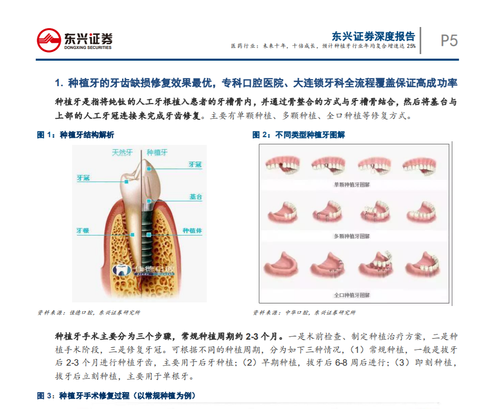 未來(lái)十年，十倍成長(zhǎng)，預(yù) 計(jì)種植牙行業(yè)年均復(fù)合增速達(dá)25%——東興證券